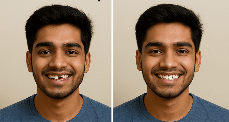 Before and after dental implant in Bhiwani